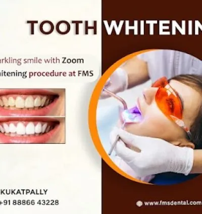 FMS DENTAL CLINICS - Best Dental Clinic in Kukatpally | KPHB